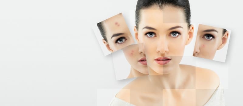 Transforma tu Cuidado de la Piel: Descubre la Dermatología Integrativa
